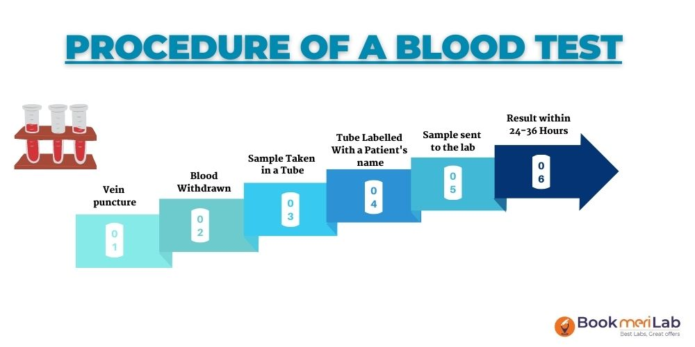 blood test procedure
