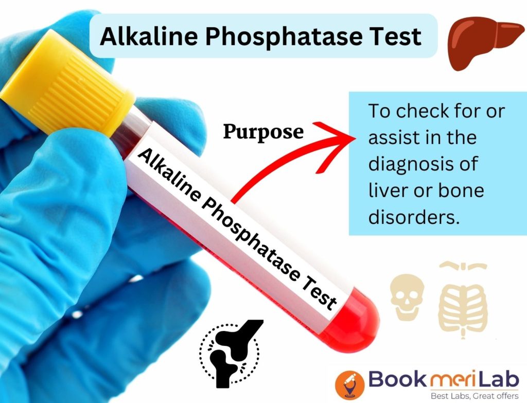 Alkaline Phosphatase test purpose