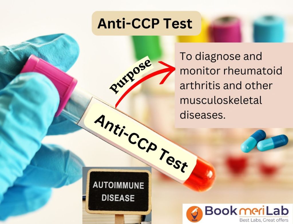 Anti-CCP Test Introduction