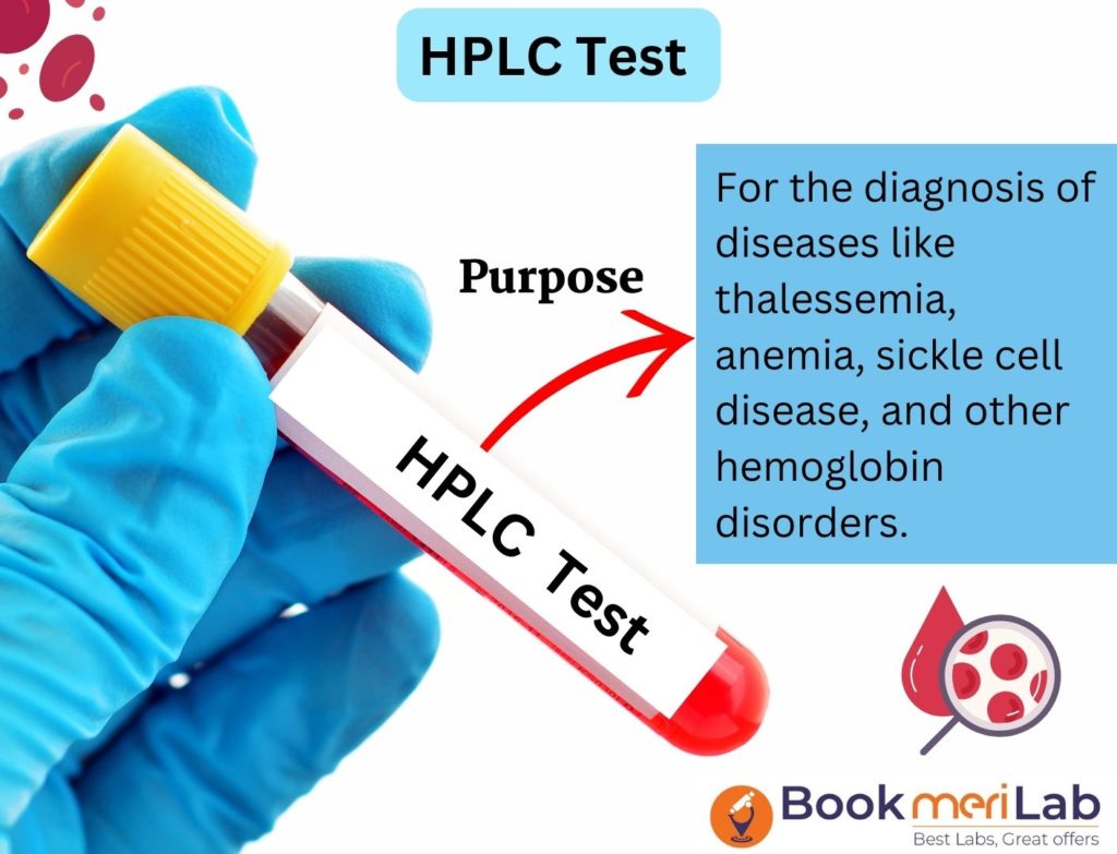 HPLC TEST INTRODUCTION
