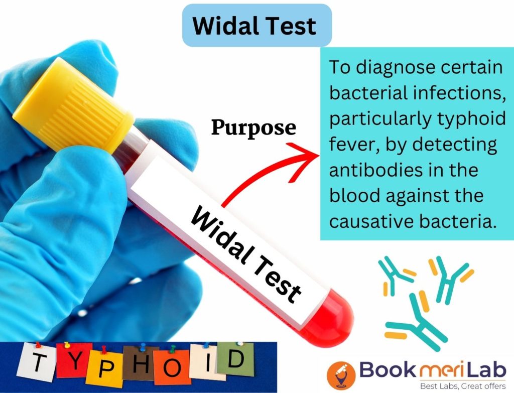 Widal test introduction