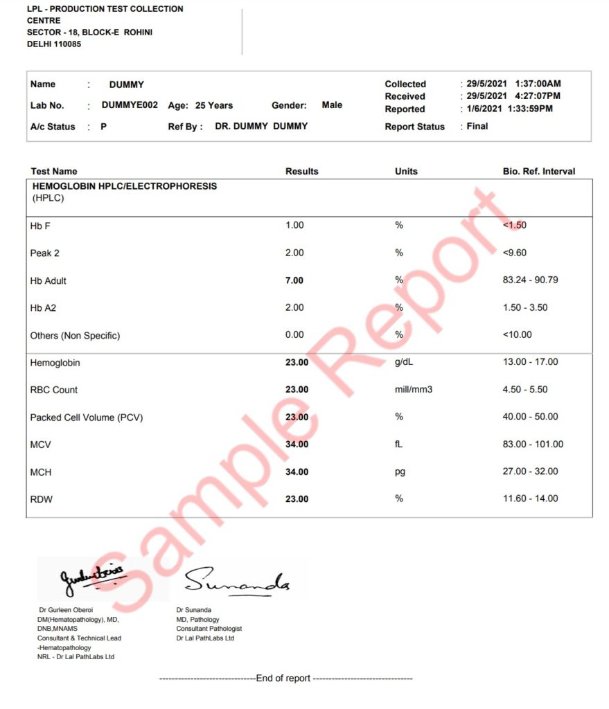 HPLC Sample Report