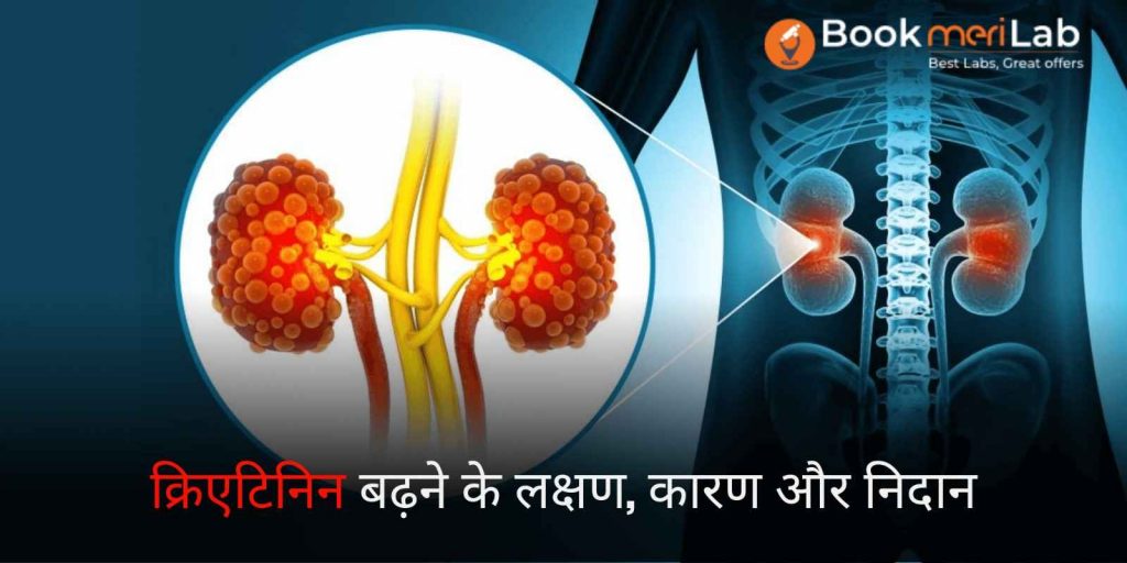 शरीर में क्रिएटिनिन बढ़ने के लक्षण, कारण और निदान 